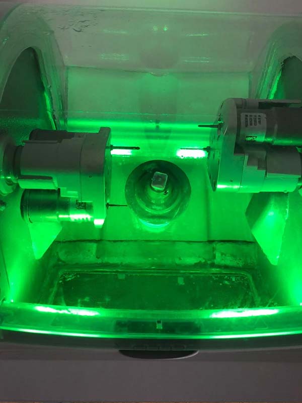 Missing Teeth Predict Strokes